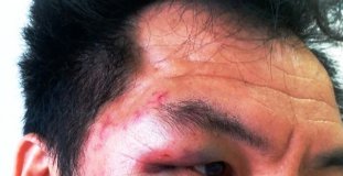 Một nhà báo bị đánh túi bụi khi đang tác nghiệp